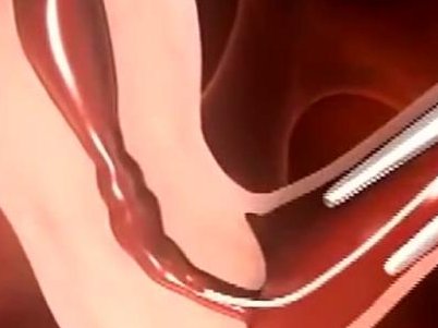 萍乡试管婴儿医院排名榜单，想做三代只能选妇幼