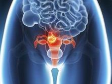 未婚女性可以做试管婴儿吗？答案可能要让你失望了